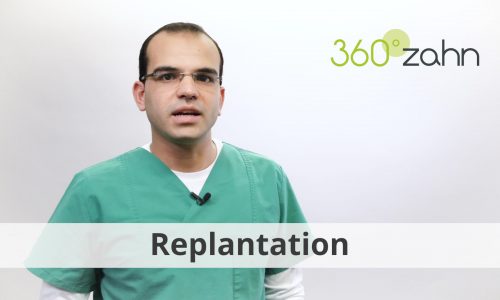 Video - Replantation