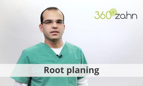 Video - Root planing