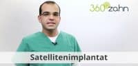 Video - Satellitenimplantat