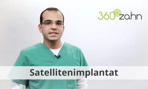 Video - Satellitenimplantat