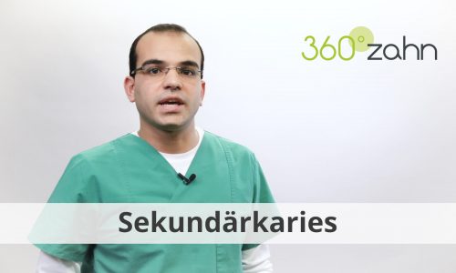 Video - Sekundärkaries