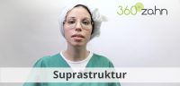 Video - Suprastruktur