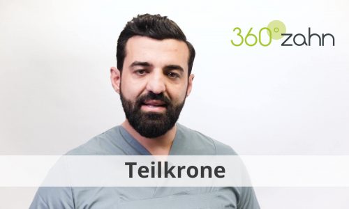 Video - Teilkrone