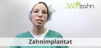 Video - Zahnimplantat