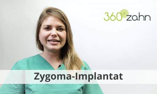 Video - Zygoma-Implantat