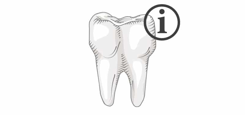 Was man über Weisheitszähne wissen sollte