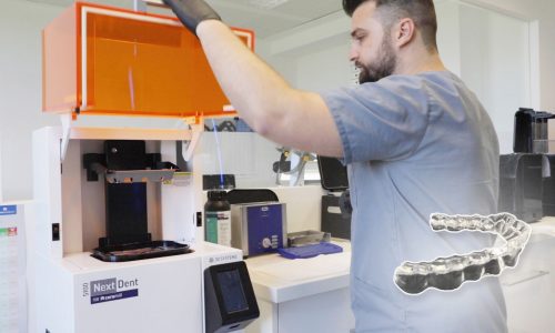 Video Knirscherschiene 3D Drucker Herstellung