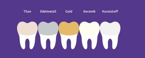 Zahnersatz Material Infos