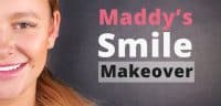 Maddy Smile Makeover