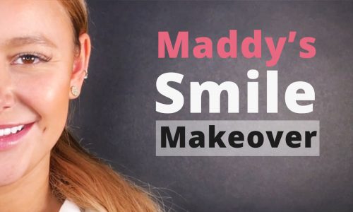 Maddy Smile Makeover