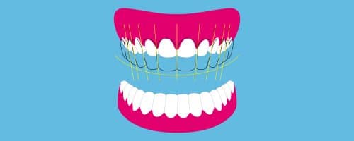 Digital Smile Design
